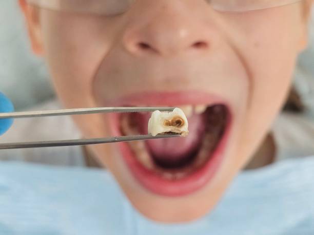 Best Emergency Care for Gum Disease in Central City, IA